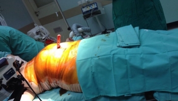 Τραύμα με μαχαίρι