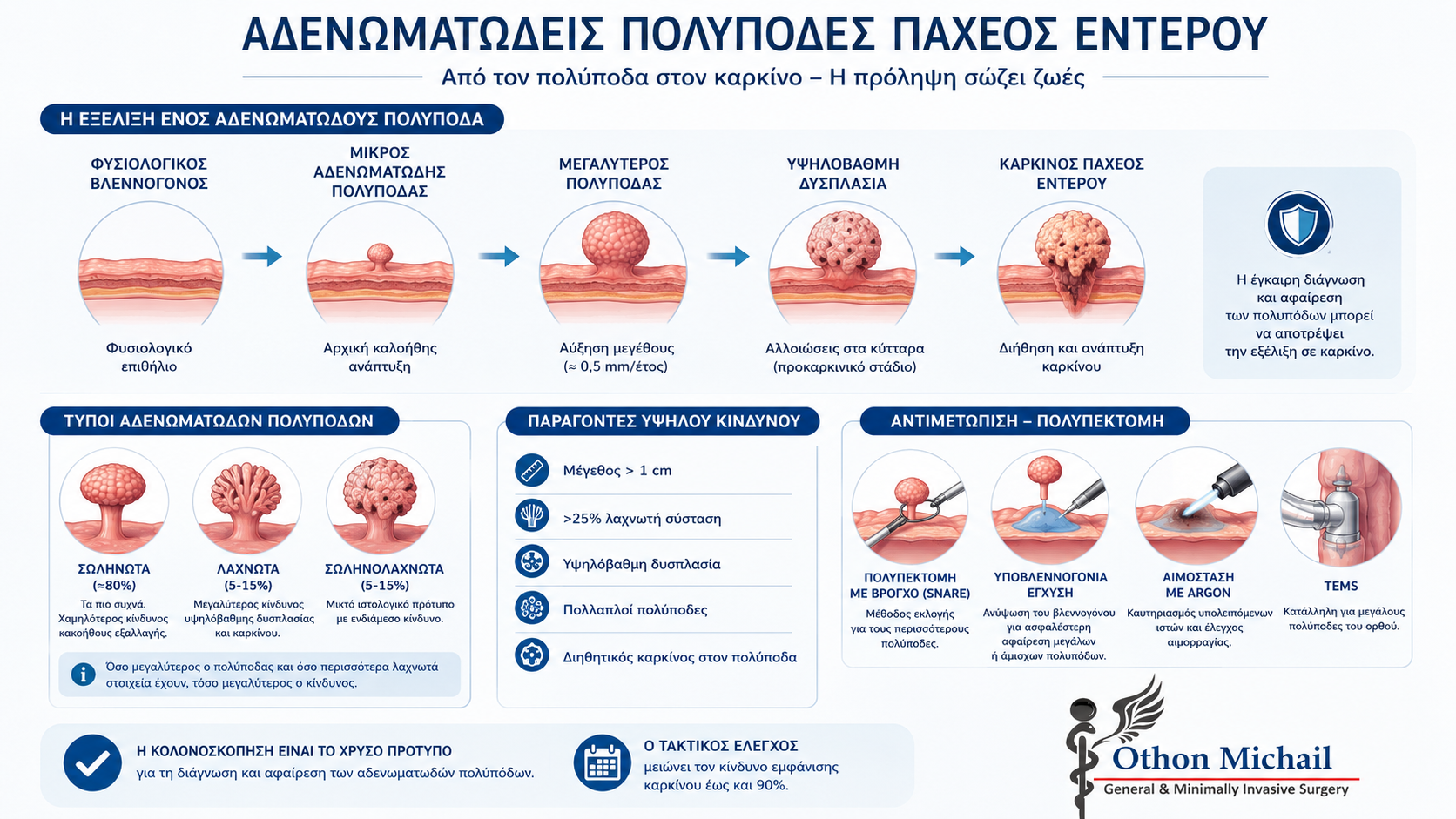 Infographic που παρουσιάζει την εξέλιξη των αδενωματωδών πολυπόδων παχέος εντέρου, τους παράγοντες κινδύνου και τις μεθόδους αφαίρεσης.