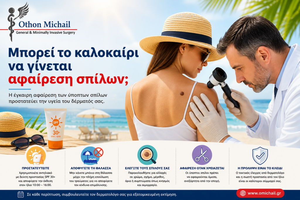 Χειρουργική αφαίρεση σπίλου κατά τη θερινή περίοδο με έμφαση στην αντηλιακή προστασία και τη σωστή επούλωση.