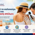 Μπορεί το καλοκαίρι να γίνεται αφαίρεση σπίλων; Χειρουργική αφαίρεση σπίλου κατά τη θερινή περίοδο με έμφαση στην αντηλιακή προστασία και τη σωστή επούλωση.