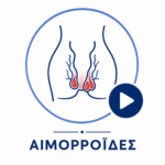 aimorroide