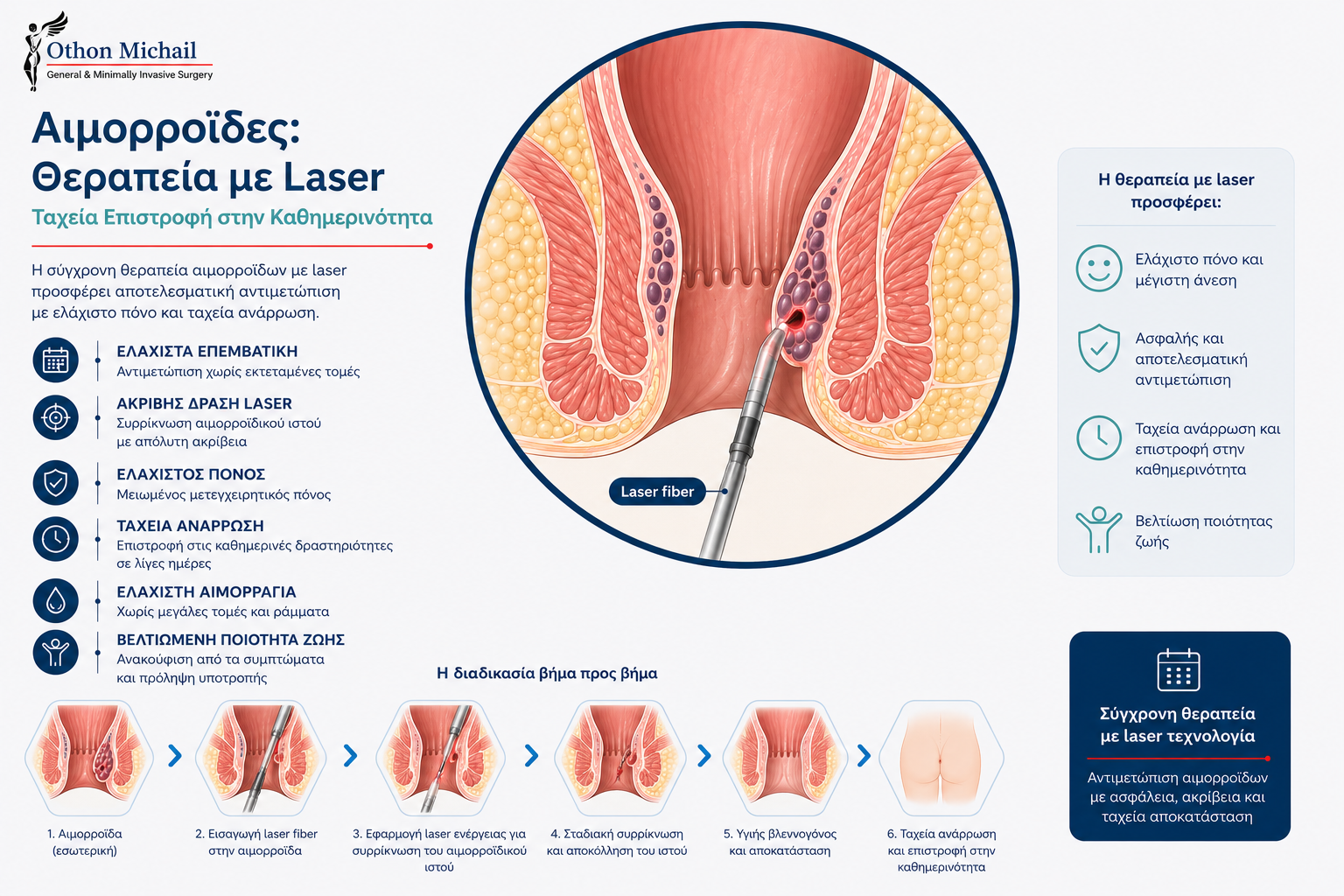 Θεραπεία αιμορροΐδων με Laser και ταχεία επιστροφή στην καθημερινότητα