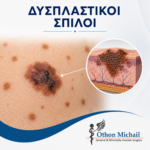 Δυσπλαστικοί σπίλοι
