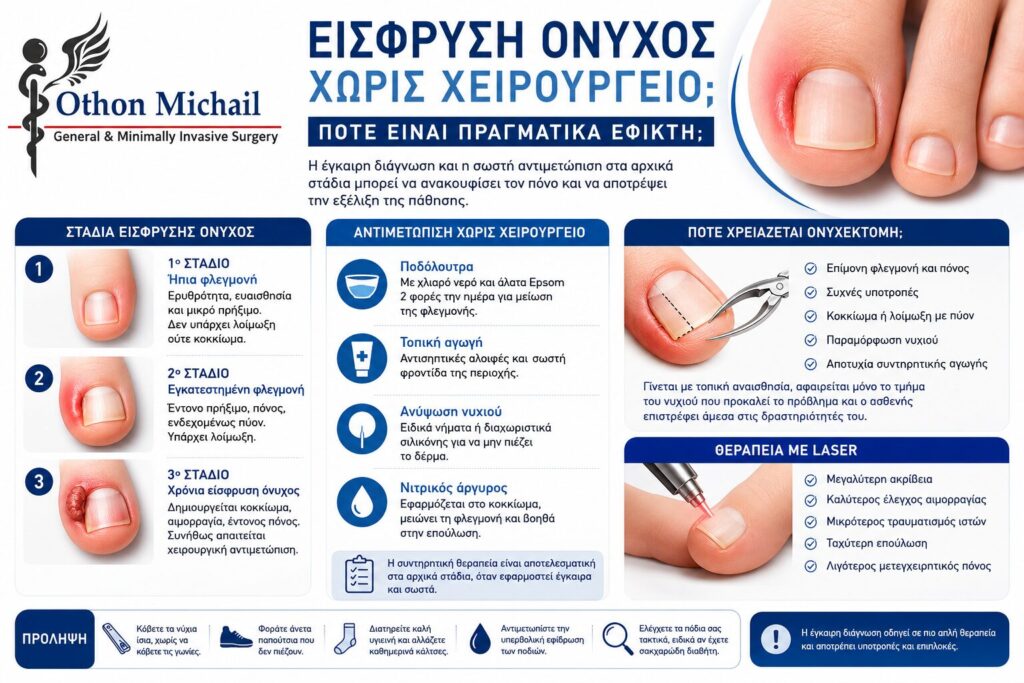 Αντιμετώπιση είσφρυσης όνυχος χωρίς χειρουργείο και θεραπευτικές επιλογές
