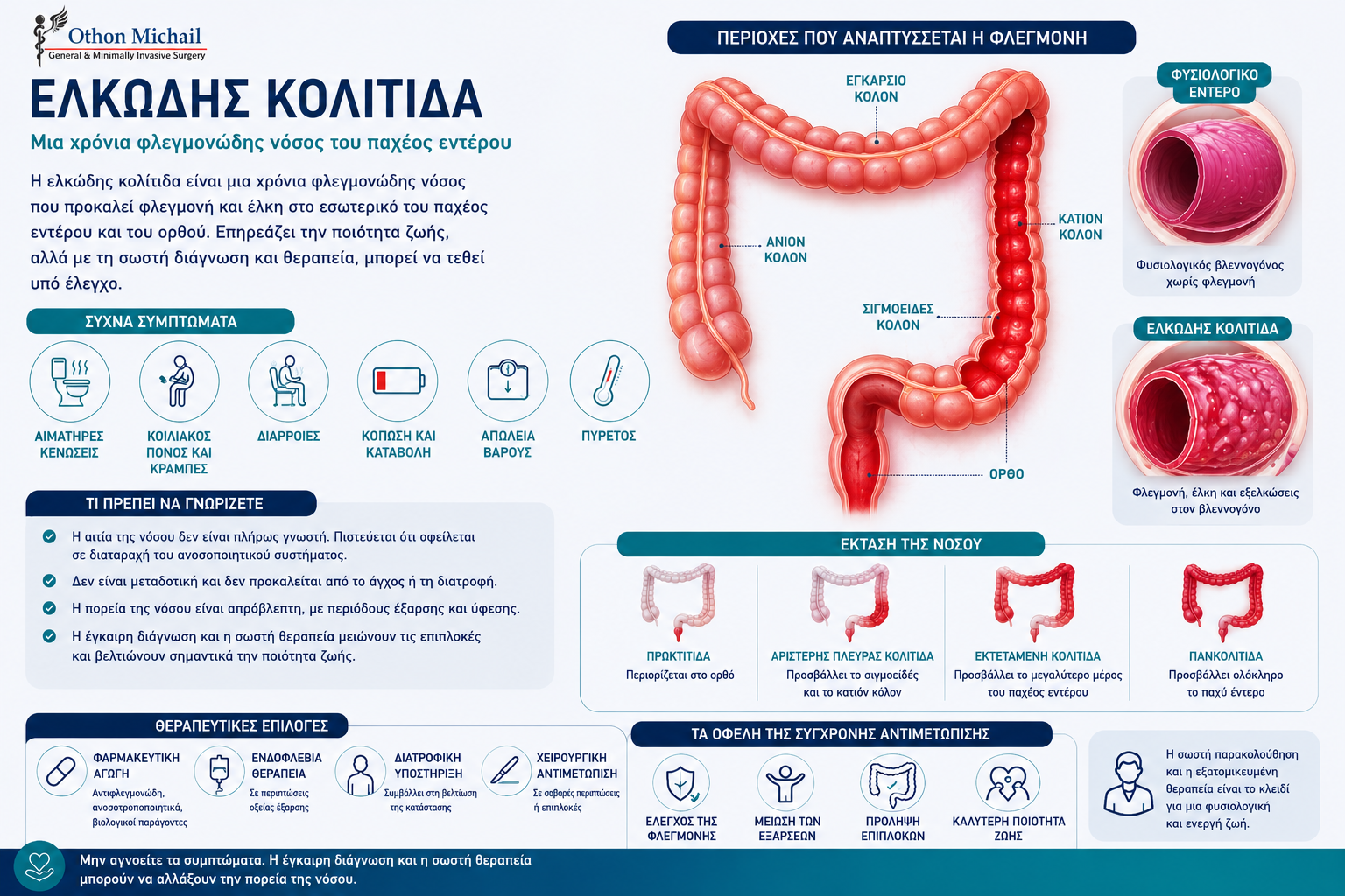 Ιατρικό infographic για την ελκώδη κολίτιδα με συμπτώματα, διάγνωση, θεραπεία και παρακολούθηση.