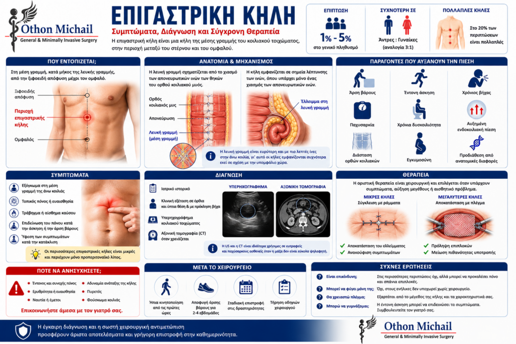 Ιατρικό infographic για την επιγαστρική κήλη με ανατομική απεικόνιση της λευκής γραμμής, συμπτώματα, διάγνωση και χειρουργική αντιμετώπιση από τον Dr. Όθωνα Μιχαήλ.