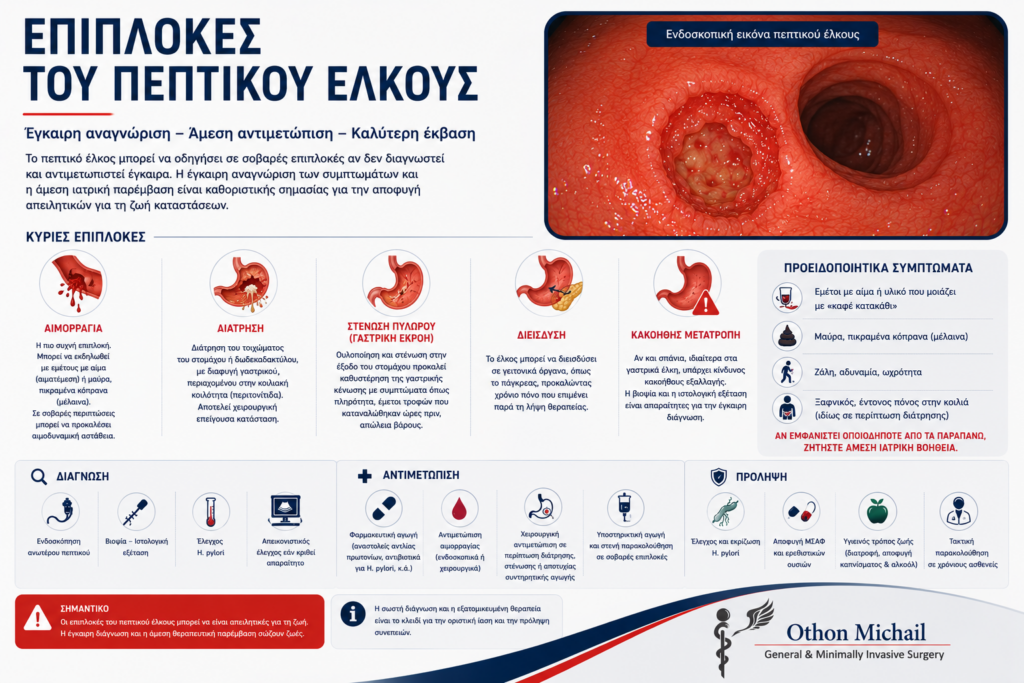 Γραφική απεικόνιση των σοβαρότερων επιπλοκών του πεπτικού έλκους