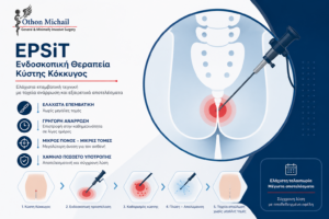 Ενδοσκοπική θεραπεία κύστης κόκκυγος EPSIT | Dr. Οθων Μιχαήλ