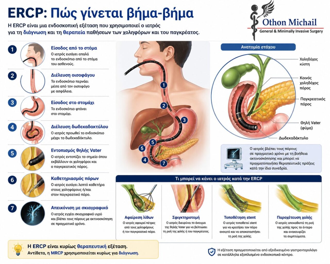 ERCP: Όσα θα θέλατε να μάθετε