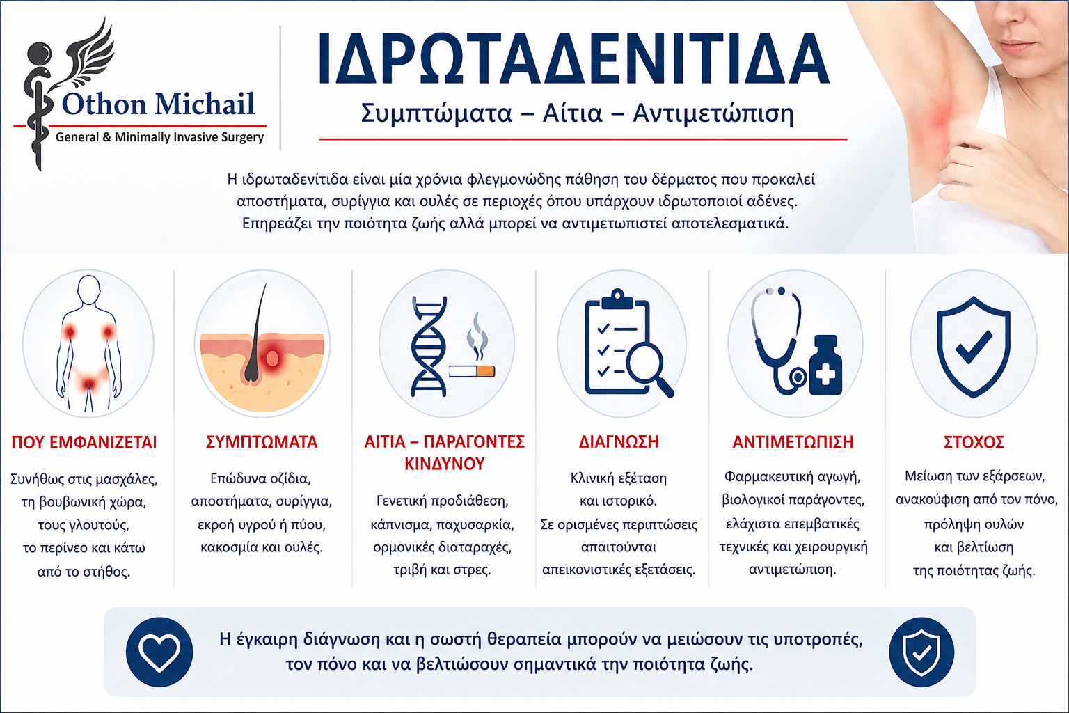 Ιδρωταδενίτιδα: συμπτώματα και θεραπεία.