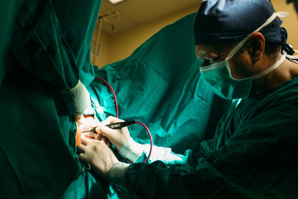 Θεραπεία ραγάδας με J-plasma απο τον χειρουργό Dr. Όθωνα Μιχαήλ