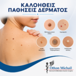 Καλοήθεις παθήσεις δέρματος και οι συχνότερες δερματικές βλάβες που αξιολογεί ο γενικός χειρουργός.