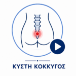 kokkygas-video