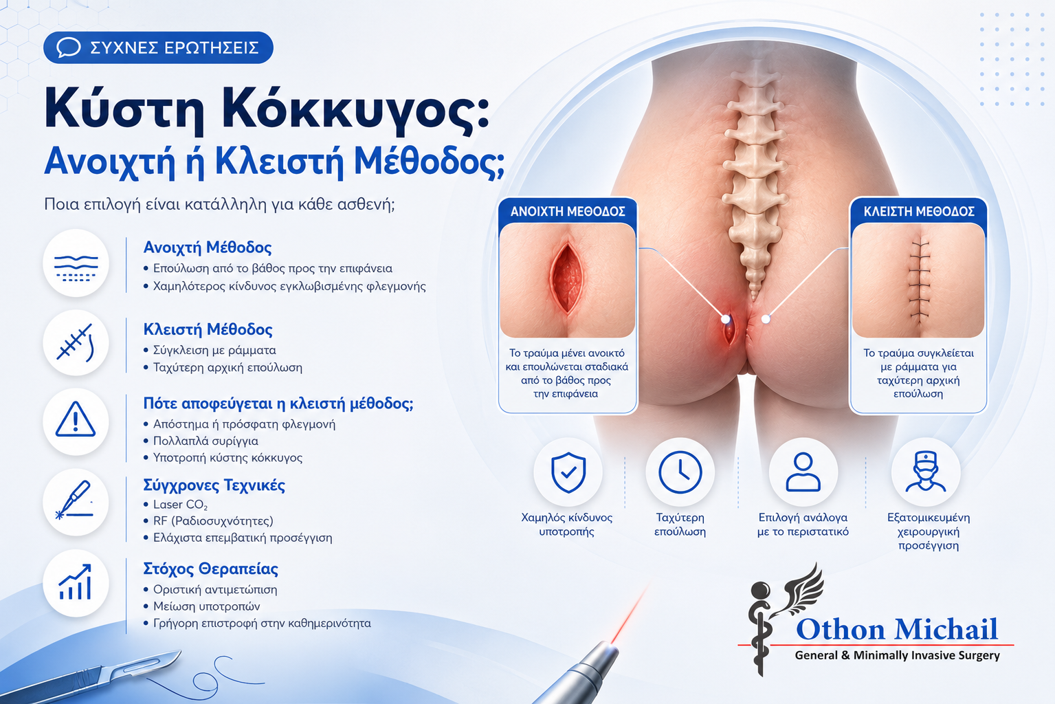 Κύστη κόκκυγος ανοιχτή ή κλειστή μέθοδος - σύγκριση χειρουργικών τεχνικών