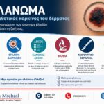 Infographic για το μελάνωμα με πληροφορίες για τον κανόνα ABCDE, τη βιοψία, τη χειρουργική θεραπεία και τη σημασία της έγκαιρης διάγνωσης.
