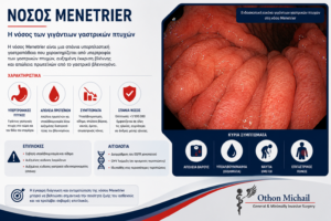 Ενδοσκοπική εικόνα νόσου Menetrier με χαρακτηριστικές υπερτροφικές πτυχές