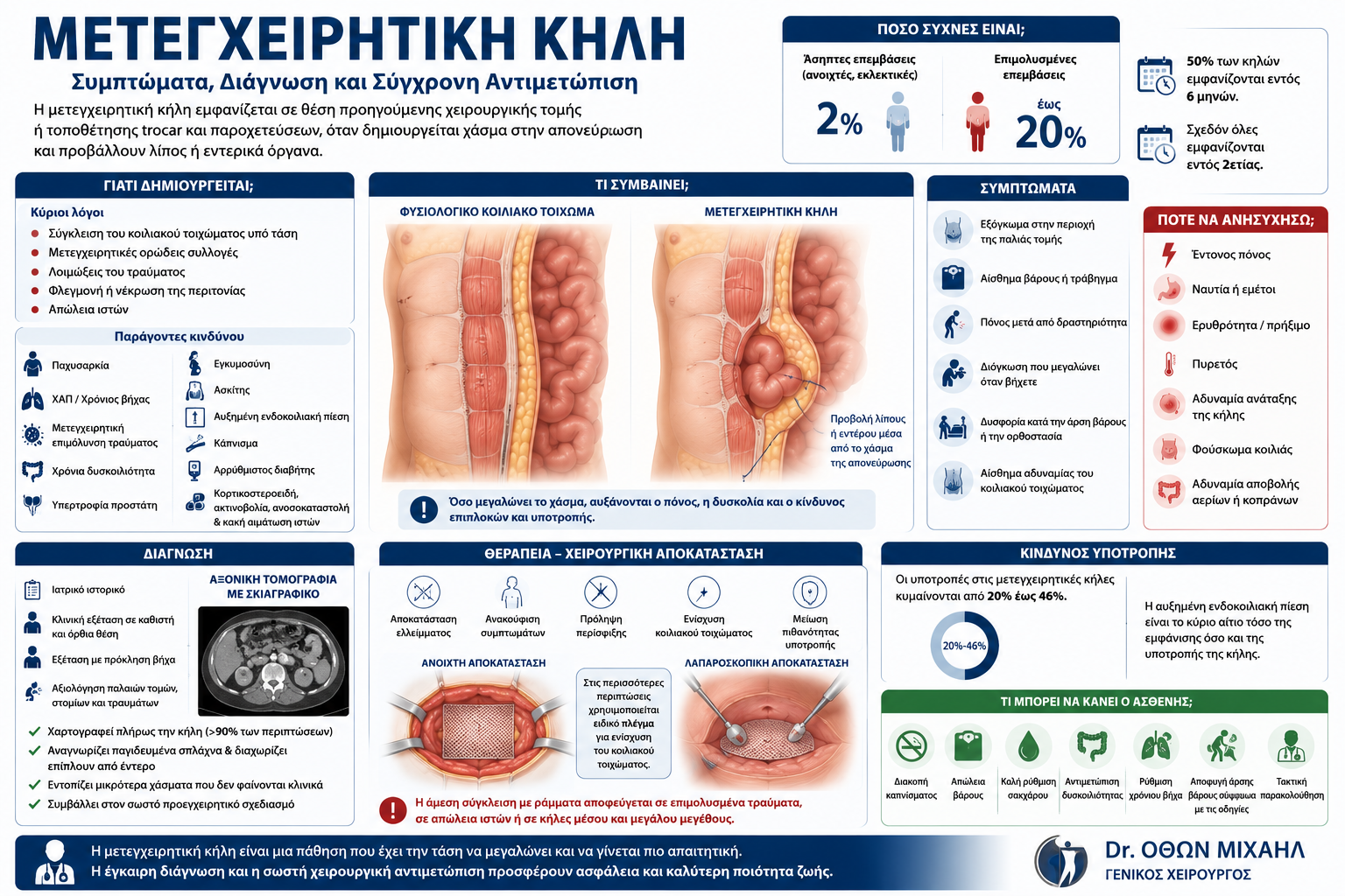 Ιατρικό infographic για τη μετεγχειρητική κήλη με ανατομική απεικόνιση του κοιλιακού τοιχώματος, συμπτώματα, διάγνωση και σύγχρονες μεθόδους αποκατάστασης από τον Dr. Όθωνα Μιχαήλ.