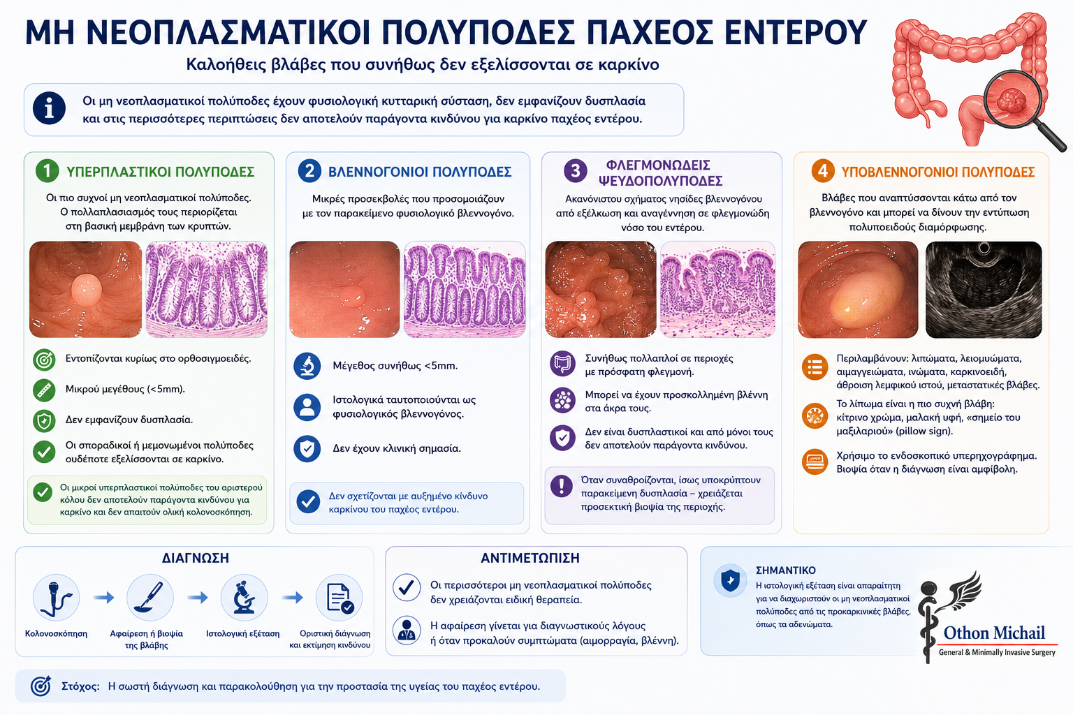 Infographic με τους κύριους τύπους μη νεοπλασματικών πολυπόδων του παχέος εντέρου.