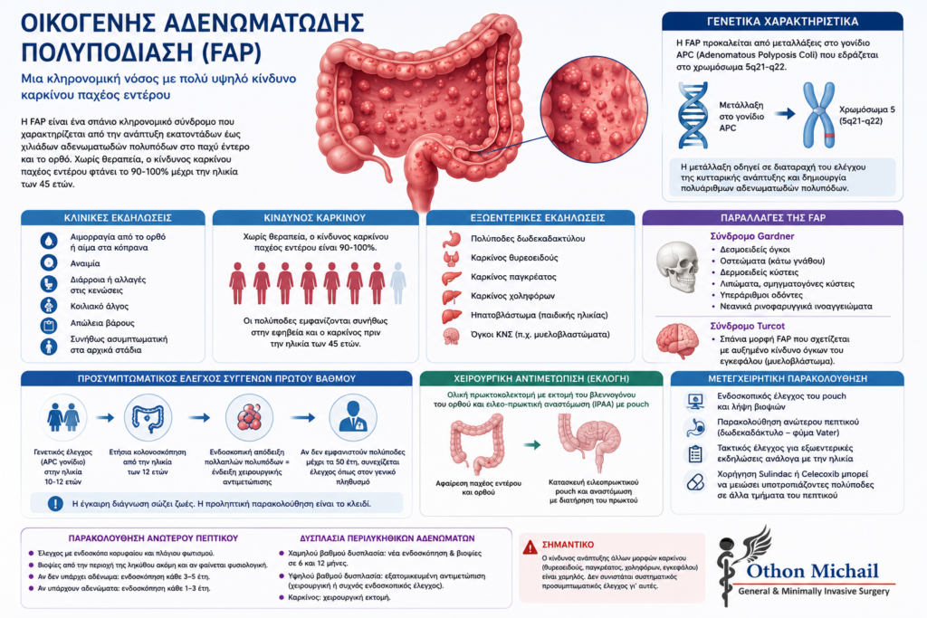 Infographic για την Οικογενή Αδενωματώδη Πολυποδίαση (FAP), τον κίνδυνο καρκίνου και τη χειρουργική αντιμετώπιση