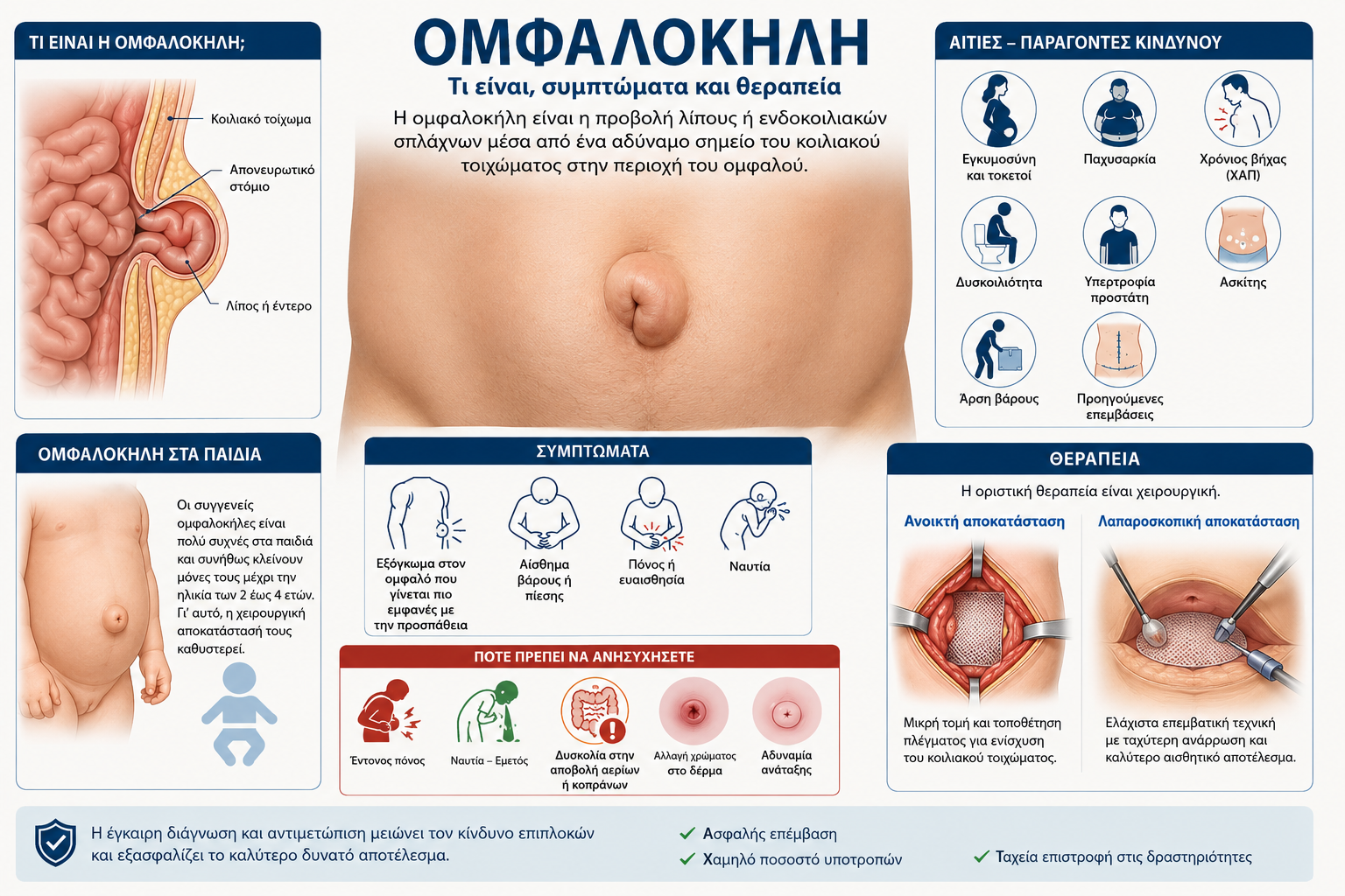 Ιατρικό infographic για την ομφαλοκήλη με ανατομική απεικόνιση, συμπτώματα, διάγνωση και σύγχρονες μεθόδους χειρουργικής αποκατάστασης από τον Dr. Όθωνα Μιχαήλ.