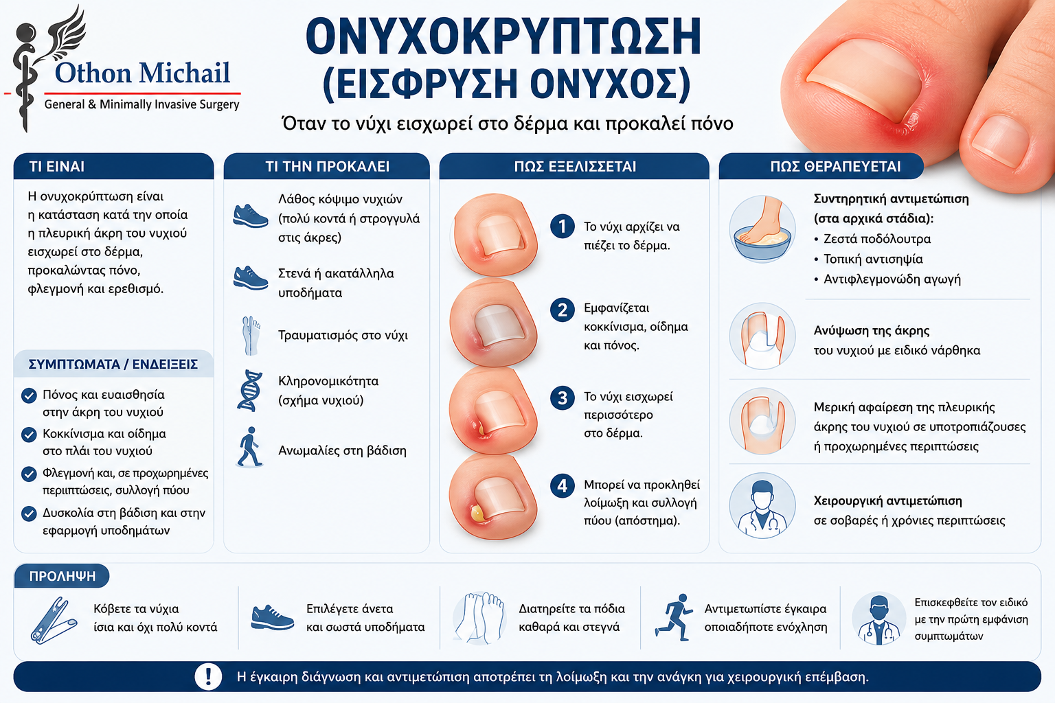 Ιατρικό infographic για την ονυχοκρύπτωση με τα συμπτώματα και τη θεραπεία της.