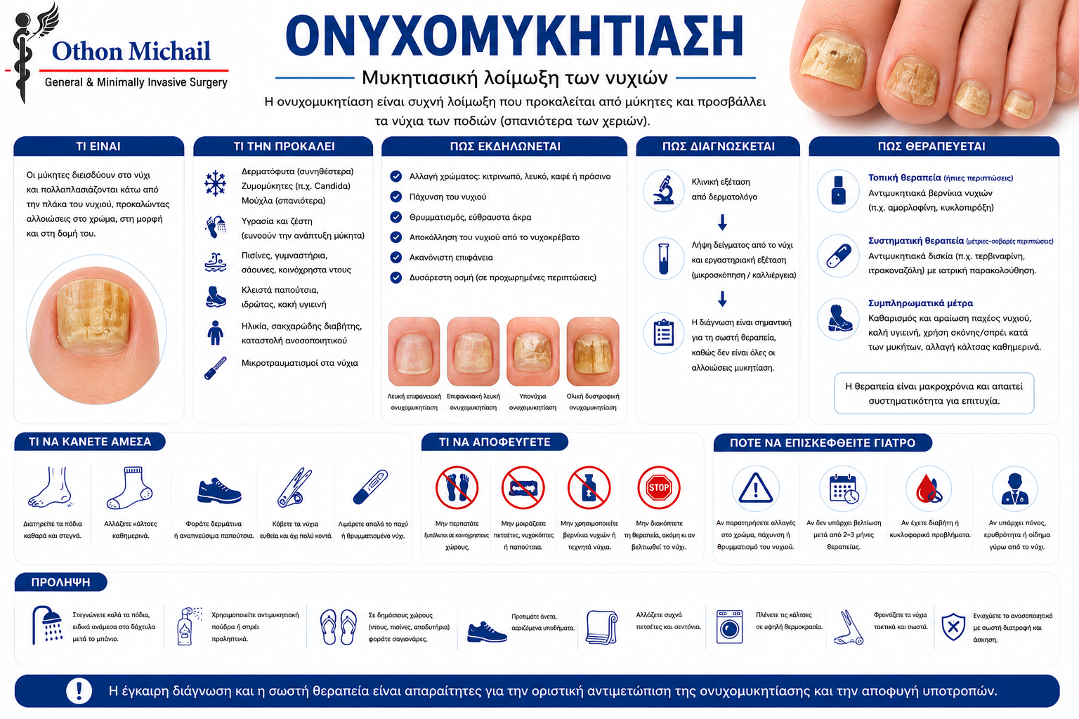 Ιατρικό infographic για την ονυχομυκητίαση με τα συμπτώματα και τις θεραπευτικές επιλογές.