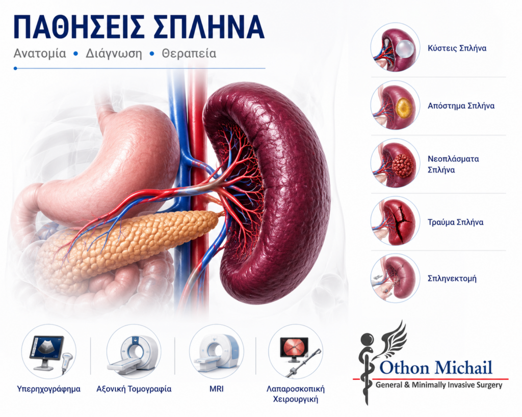 Ιατρικό infographic με ανατομία του σπλήνα, συχνές παθήσεις, διαγνωστικές εξετάσεις και χειρουργικές θεραπευτικές επιλογές