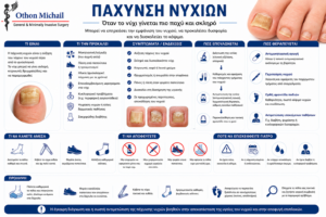 Ιατρικό infographic για την πάχυνση των νυχιών και τις θεραπευτικές επιλογές.