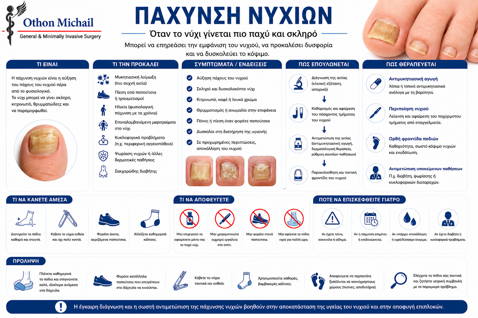 Ιατρικό infographic για την πάχυνση των νυχιών και τις θεραπευτικές επιλογές.
