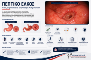 Ιατρικό infographic για το πεπτικό έλκος με τα συχνότερα συμπτώματα, τις πιθανές επιπλοκές και τις σύγχρονες θεραπευτικές επιλογές.