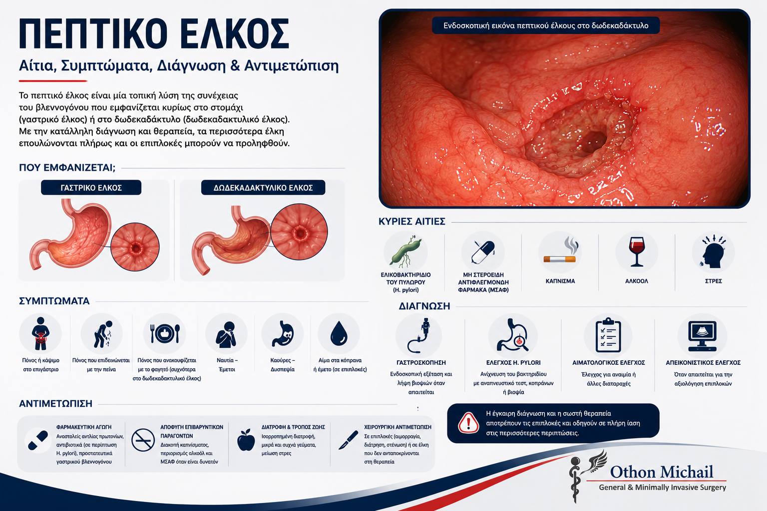Ιατρικό infographic για το πεπτικό έλκος με τα συχνότερα συμπτώματα, τις πιθανές επιπλοκές και τις σύγχρονες θεραπευτικές επιλογές.
