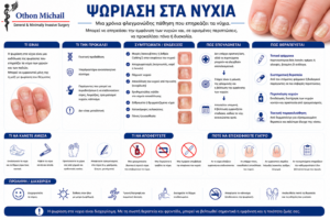 Ιατρικό infographic για την ψωρίαση στα νύχια με τα χαρακτηριστικά συμπτώματα και τη θεραπεία.