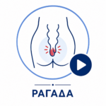 ragada
