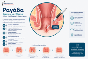 Θεραπεία ραγάδας πρωκτού με J-Plasma και ψυχρό πλάσμα Ηλίου
