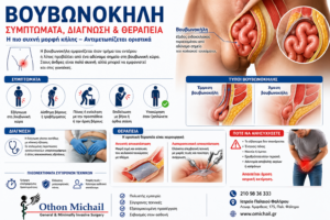 Ιατρικό infographic για τη βουβωνοκήλη με ανατομική απεικόνιση, συμπτώματα, διάγνωση και σύγχρονες μεθόδους χειρουργικής αποκατάστασης από τον Dr. Όθωνα Μιχαήλ.