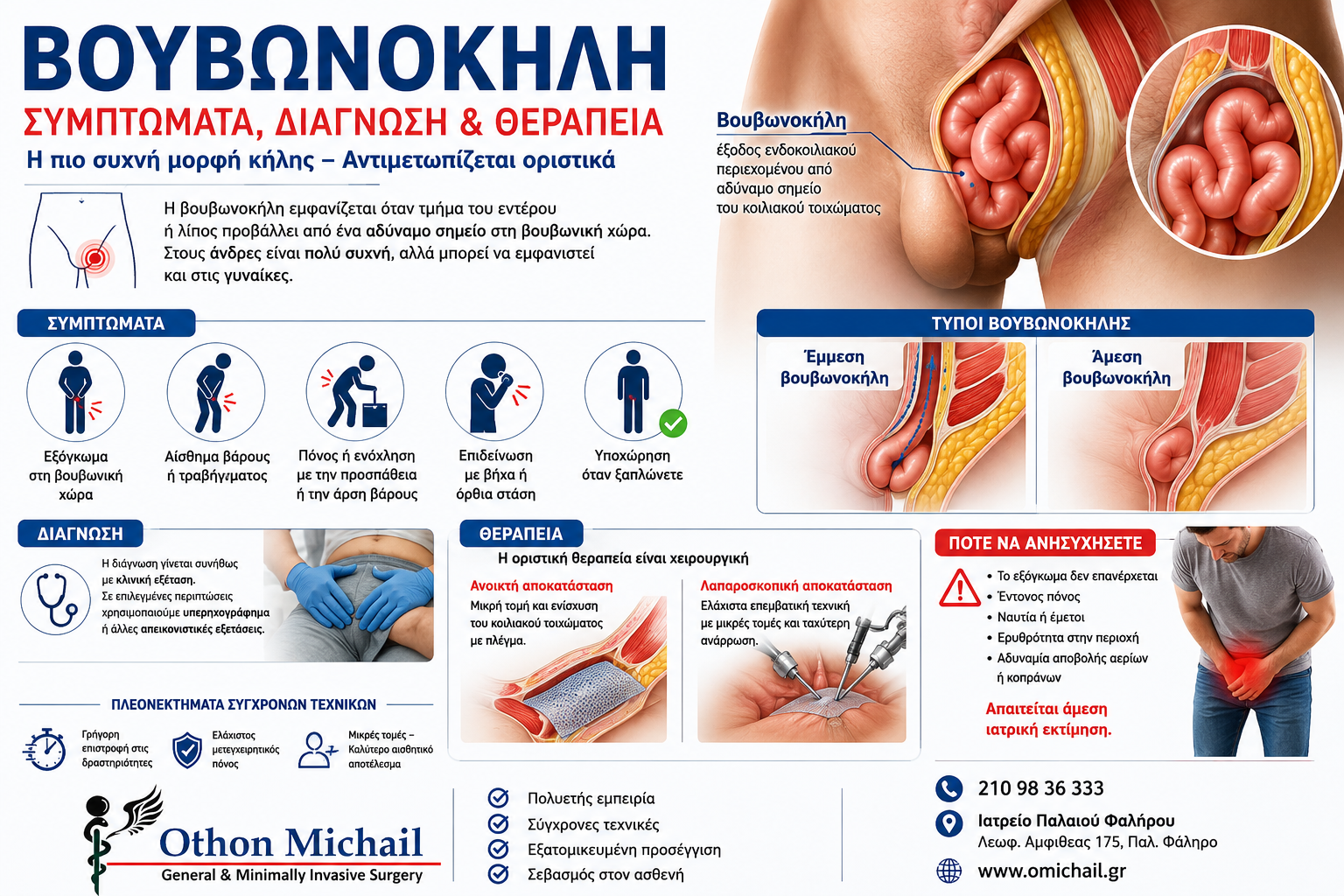 Ιατρικό infographic για τη βουβωνοκήλη με ανατομική απεικόνιση, συμπτώματα, διάγνωση και σύγχρονες μεθόδους χειρουργικής αποκατάστασης από τον Dr. Όθωνα Μιχαήλ.