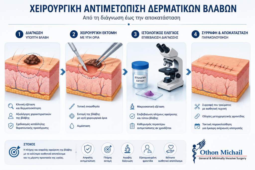 Ιατρικό infographic που παρουσιάζει τα στάδια της χειρουργικής αντιμετώπισης δερματικών βλαβών, από τη διάγνωση έως την ιστολογική εξέταση και την αποκατάσταση.