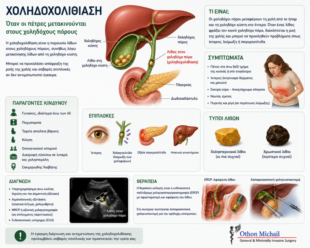 Ιατρικό infographic για τη χοληδοχολιθίαση με συμπτώματα, διάγνωση και θεραπεία με ERCP.