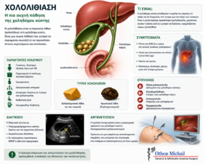 Ιατρικό infographic για τη χολολιθίαση με συμπτώματα, επιπλοκές και θεραπεία