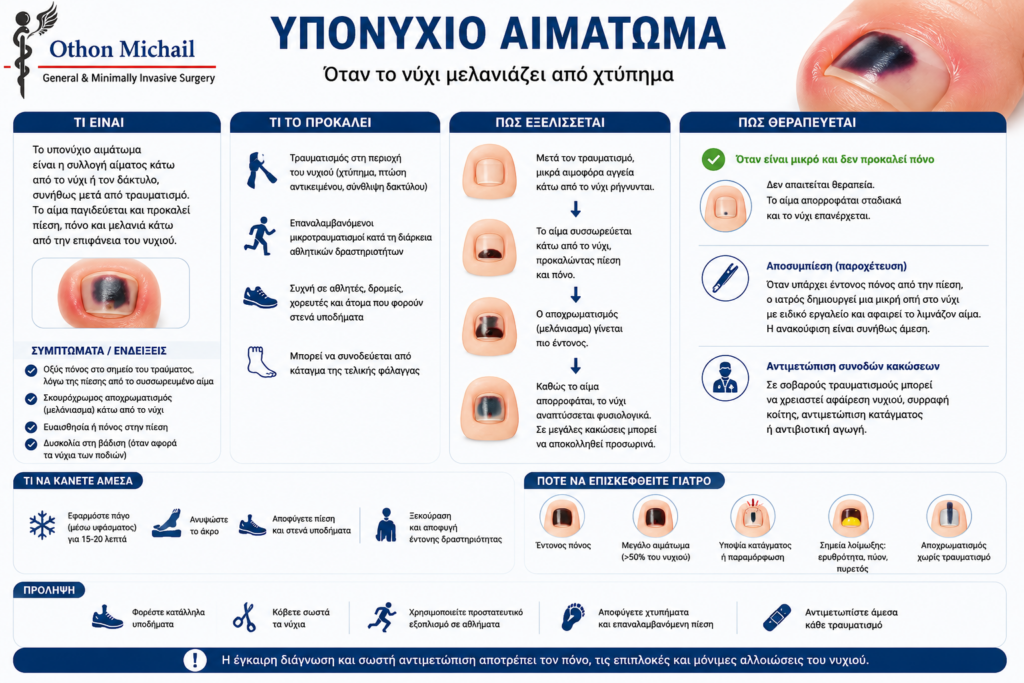 Ιατρικό infographic για το υπονύχιο αιμάτωμα, τα συμπτώματα και τη θεραπεία του.