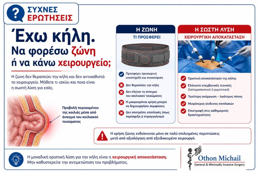 Ζώνη για κήλη ή χειρουργείο - ενημερωτικό infographic