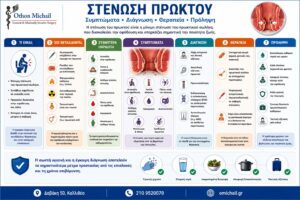 Στένωση πρωκτού - αίτια, συμπτώματα, διάγνωση, θεραπεία και πρόληψη