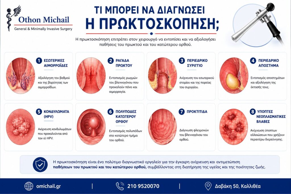 Ιατρικό infographic που παρουσιάζει τις παθήσεις που μπορεί να διαγνώσει η πρωκτοσκόπηση, όπως εσωτερικές αιμορροΐδες, ραγάδα πρωκτού, περιεδρικό συρίγγιο, περιεδρικό απόστημα, κονδυλώματα, πολύποδες κατώτερου ορθού, προκτίτιδα και ύποπτες νεοπλασματικές βλάβες.