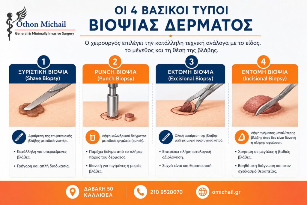 Infographic που παρουσιάζει τους τέσσερις βασικούς τύπους βιοψίας δέρματος: ξυριστική βιοψία (Shave Biopsy), Punch Biopsy, εκτομή βιοψίας (Excisional Biopsy) και εντομή βιοψίας (Incisional Biopsy).